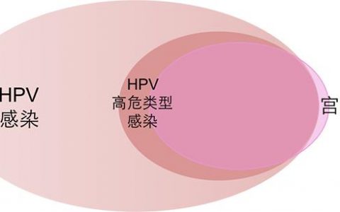 HPV和宮頸癌有何關(guān)系 HPV疫苗咋打 干貨在這